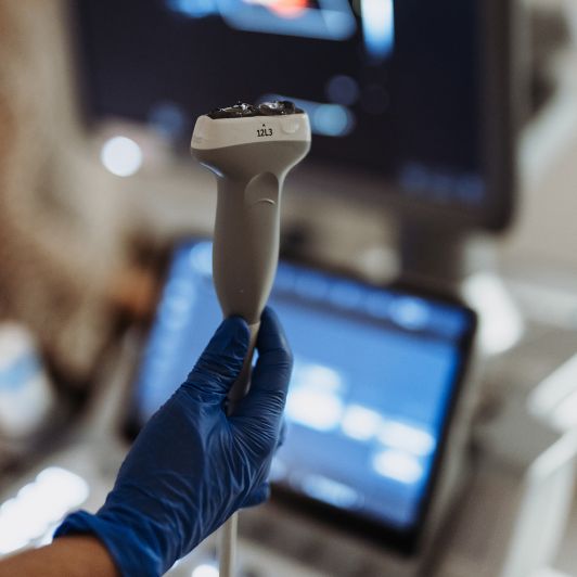 Eine Hand mit blauen Schutzhandschuh hält einen Ultraschallkopf für einen Gefäßultraschall vor einem verschwommenen Hintergrund mit medizinischen Bildschirmen.